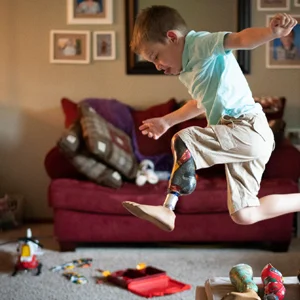 a kid with a prosthetic leg leaps into frame